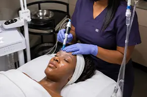 SkinPen Deep Ellum treatment underway, device tracing the cheek as the client rests with eyes closed