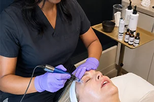SkinPen Lakewood microneedling pass across the forehead, softening lines with controlled pressure
