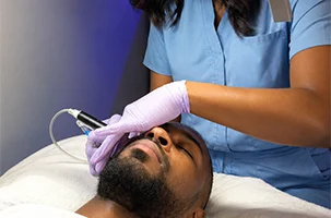 Provider in blue scrubs works the microneedling device along the temple in a SkinPen North Dallas session