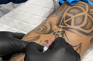 Syringe meets a tattooed upper arm as a provider administers a vitamin injection in North Dallas